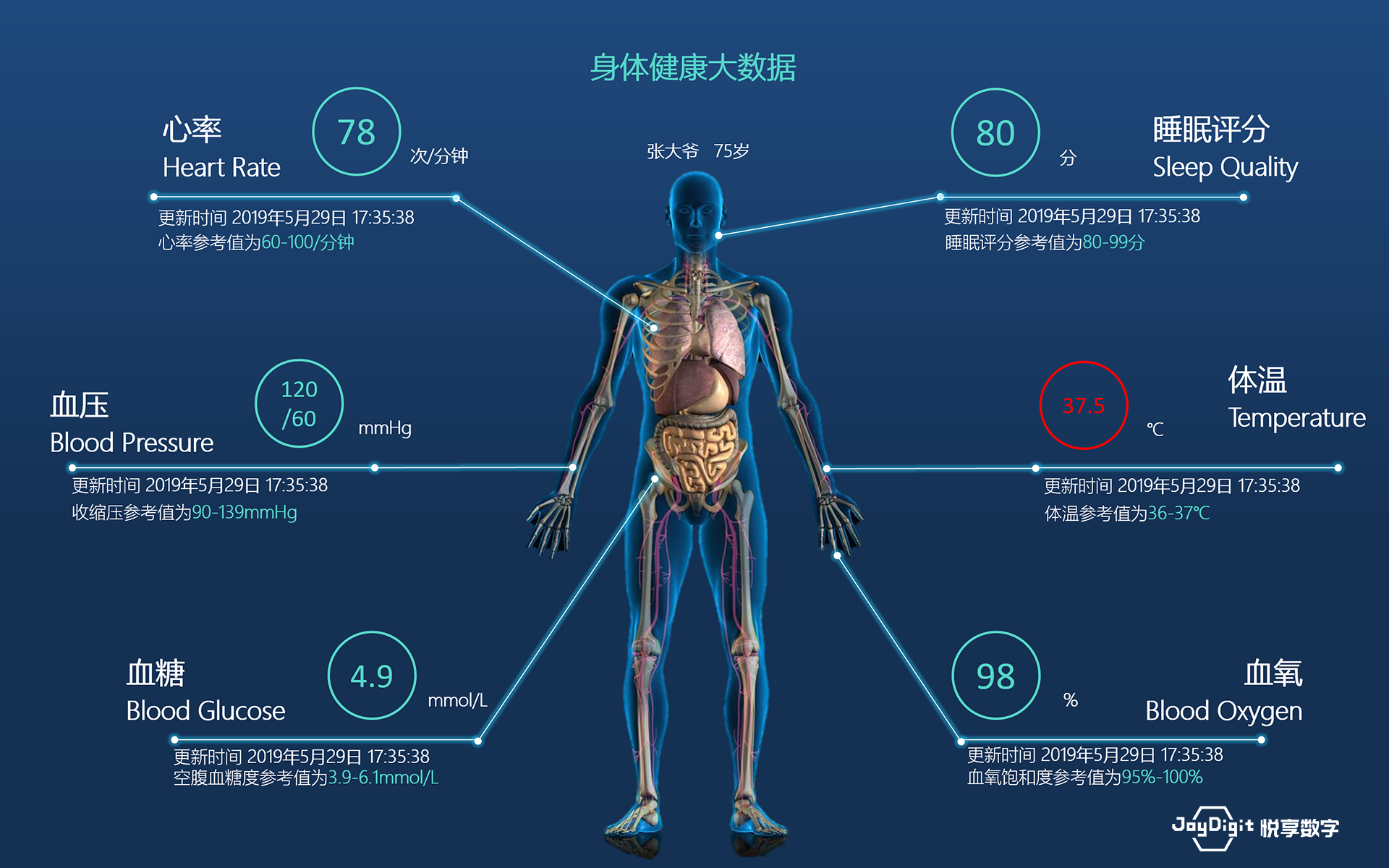 消費日報：悅享數(shù)字推動新興技術與養(yǎng)老服務相結(jié)合，加快養(yǎng)老行業(yè)數(shù)字化轉(zhuǎn)型(圖9)